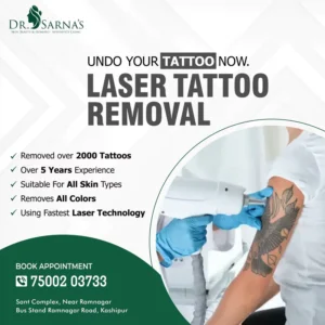 our experience and technique in tattoo removal service is showing
