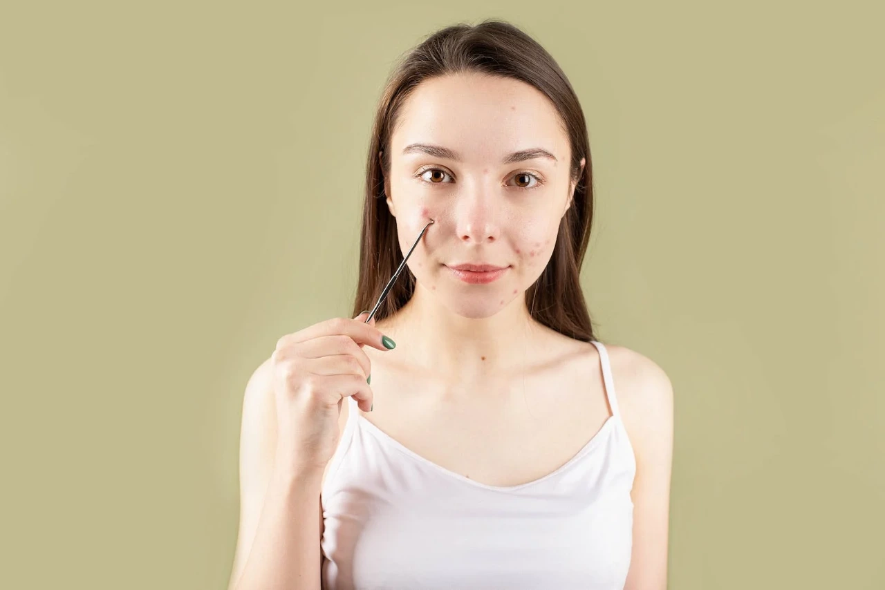 a woman showing her face pimples with a special stick