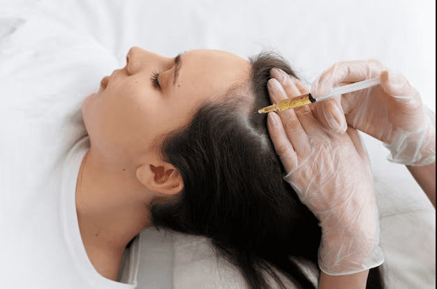 Platelet-rich plasma (PRP) treatment for hair